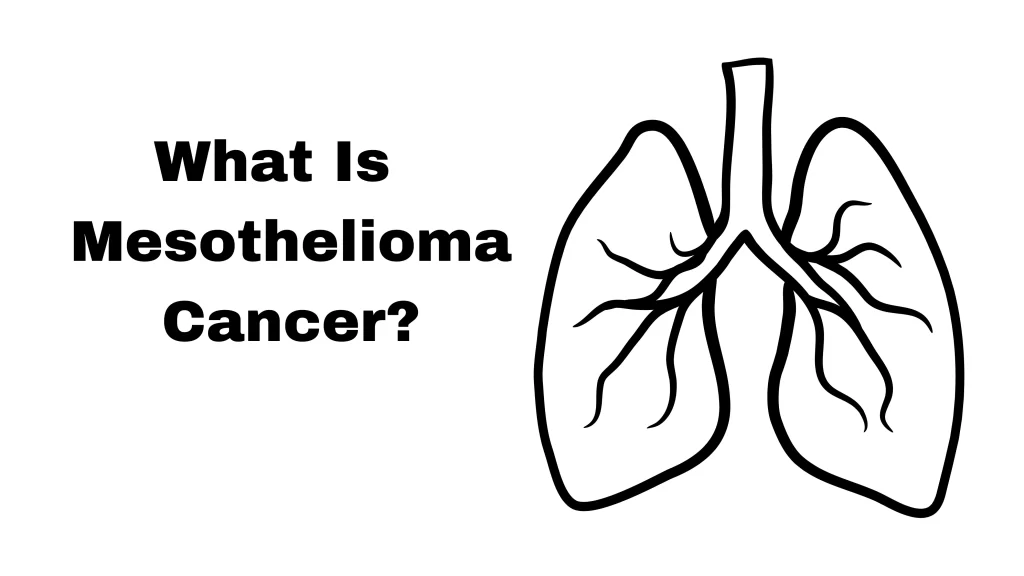 What Is Mesothelioma Cancer: Everything You Should Know